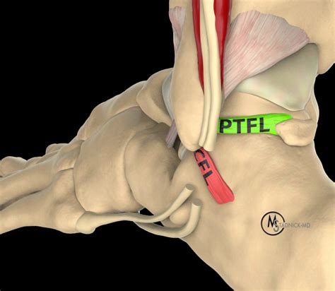 test for a calcaneofibular ligament tear|calcaneofibular ligament origin and insertion.